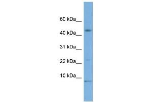 Western Blotting (WB) image for anti-Macrophage Migration Inhibitory Factor (Glycosylation-Inhibiting Factor) (MIF) (Middle Region) antibody (ABIN2786654)