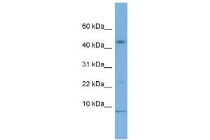 WB Suggested Anti-MIF Antibody Titration: 0. (MIF 抗体  (Middle Region))
