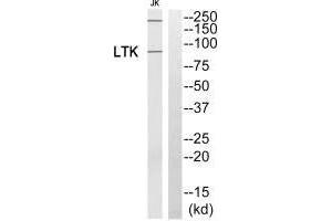 Western blot analysis of extracts from Jurkat cells, using LTK antibody. (LTK 抗体)