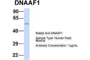 Host: Rabbit  Target Name: DNAAF1  Sample Tissue: Human Fetal Muscle  Antibody Dilution: 1. (LRRC50 抗体  (N-Term))