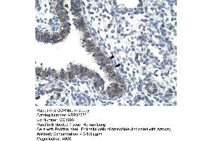 Human Lung (CCRN4L 抗体  (N-Term))