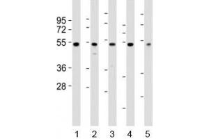 Western blot testing of NFKBIE antibody at 1:2000 dilution. (NFKBIE 抗体  (N-Term))
