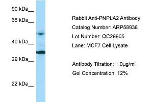 Western Blotting (WB) image for anti-Patatin-Like phospholipase Domain Containing 2 (PNPLA2) (Middle Region) antibody (ABIN2787884) (PNPLA2 抗体  (Middle Region))