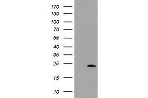 Image no. 1 for anti-Cystatin S (CST4) antibody (ABIN1497668) (CST4 抗体)