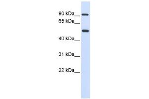 LOXL1 antibody used at 1 ug/ml to detect target protein. (LOXL1 抗体  (Middle Region))