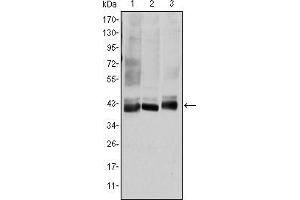 Western blot analysis using MAP2K4 mouse mAb against HepG2 (1), K562 (2), and HEK293 (3) cell lysate. (MAP2K4 抗体)