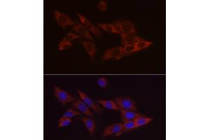 Immunofluorescence (IF) image for anti-B-Cell CLL/lymphoma 2 (BCL2) antibody (ABIN7265809)