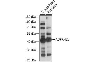 Western blot analysis of extracts of various cell lines, using ADPRHL1 antibody (ABIN6292800) at 1:1000 dilution. (ADPRHL1 抗体)