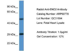 Western Blotting (WB) image for anti-Enolase 2 (Gamma, Neuronal) (ENO2) (N-Term) antibody (ABIN786270) (ENO2/NSE 抗体  (N-Term))