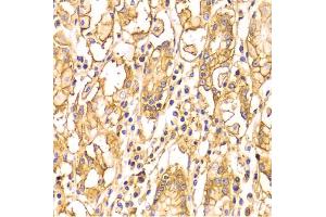 Immunohistochemistry of paraffin-embedded human stomach using BSG Antibody (ABIN5970747) at dilution of 1/100 (40x lens). (CD147 抗体)
