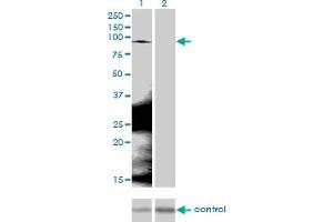 Western Blotting (WB) image for anti-Catenin (Cadherin-Associated Protein), beta 1, 88kDa (CTNNB1) (AA 682-781) antibody (ABIN514758)