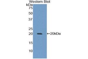 Western Blotting (WB) image for anti-Matrix Metallopeptidase 9 (Gelatinase B, 92kDa Gelatinase, 92kDa Type IV Collagenase) (MMP9) (AA 225-390) antibody (ABIN1173112) (MMP 9 抗体  (AA 225-390))