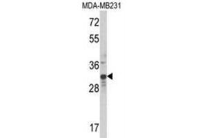 Western blot analysis of MLX Antibody (Center) in MDA-MB231 cell line lysates (35ug/lane). (MLX 抗体  (Middle Region))