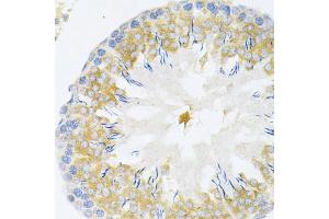 Immunohistochemistry of paraffin-embedded rat testis using TAPBP Antibody (ABIN1875423) at dilution of 1:200 (40x lens). (TAPBP 抗体)