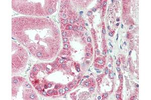 Anti-C25H / CH25H antibody IHC staining of human kidney. (CH25H 抗体  (AA 190-239))