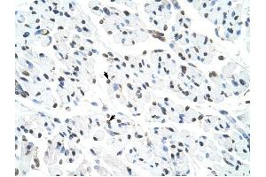 Matrin 3 antibody was used for immunohistochemistry at a concentration of 4-8 ug/ml to stain Skeletal muscle cells (arrows) in Human Muscle. (MATR3 抗体  (N-Term))