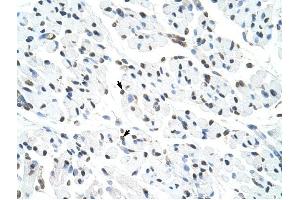 Matrin 3 antibody was used for immunohistochemistry at a concentration of 4-8 ug/ml to stain Skeletal muscle cells (arrows) in Human Muscle. (MATR3 抗体  (N-Term))