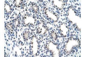 THOC4 antibody was used for immunohistochemistry at a concentration of 4-8 ug/ml to stain Alveolar cells (arrows) in Human Lung. (THO Complex 4 抗体  (N-Term))
