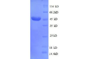 CD320 Molecule (CD320) (AA 36-231), (partial) protein (GST tag)