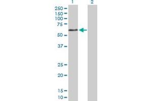 Western Blot analysis of DVL1 expression in transfected 293T cell line by DVL1 MaxPab polyclonal antibody. (DVL1 抗体  (AA 1-444))