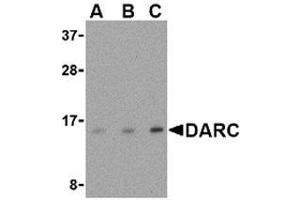 Western blot analysis of DARC in PC-3 cell lysate with AP30274PU-N DARC antibody at (A) 0. (DARC 抗体  (N-Term))