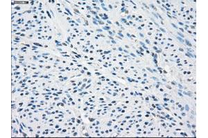 Immunohistochemical staining of paraffin-embedded endometrium tissue using anti-SLC2A5mouse monoclonal antibody. (SLC2A5 抗体)