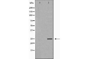 Western blot analysis of MCF7 cell lysate, using PRG2 Antibody. (PRG2 抗体  (Internal Region))