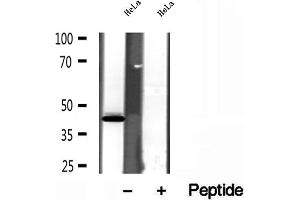 SPOP-B Antikörper  (Internal Region)