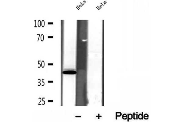 SPOP-B Antikörper  (Internal Region)