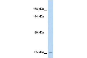 SLC19A1 antibody used at 5 ug/ml to detect target protein. (SLC19A1 抗体)