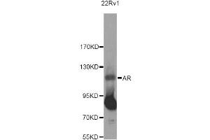 Western blot analysis of extracts of 22RV1 cells, using AR Antibody (ABIN5971084) at 1/500 dilution. (Androgen Receptor 抗体)