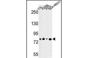 Western blot analysis of CSRP2BP Antibody (Center) (ABIN652812 and ABIN2842530) in Y79, , , MDA-M cell line lysates (35 μg/lane). (CSRP2BP 抗体  (AA 246-275))