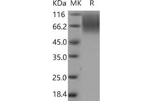 Western Blotting (WB) image for Carcinoembryonic Antigen-Related Cell Adhesion Molecule 1 (CEACAM1) protein (His tag) (ABIN7321183) (CEACAM1 Protein (His tag))