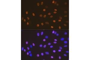 Immunofluorescence analysis of C6 cells using SOX10 Rabbit mAb (ABIN7270567) at dilution of 1:100 (40x lens). (SOX10 抗体)