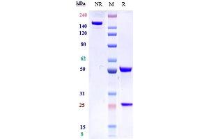 Anti-IL-7Ra / CD127 Reference Antibody (lusvertikimab) on SDS-PAGE under reducing (R) condition. (Recombinant IL7RA (Lusvertikimab Biosimilar) 抗体)