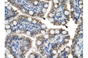 C20ORF100 antibody was used for immunohistochemistry at a concentration of 4-8 ug/ml to stain Epithelial cells of intestinal villus (arrows) in Human Intestine. (TOX2 抗体  (N-Term))