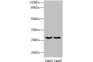 Western blot All lanes: OCIAD1 antibody at 1 μg/mL Lane 1: Mouse liver tissue Lane 2: Mouse kidney tissue Secondary Goat polyclonal to rabbit IgG at 1/10000 dilution Predicted band size: 28, 21, 22 kDa Observed band size: 28 kDa (OCIAD1 抗体  (AA 1-245))