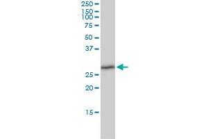 TXNDC9 monoclonal antibody (M02), clone 1E8-7C12 Western Blot analysis of TXNDC9 expression in K-562 . (TXNDC9 抗体  (AA 1-226))