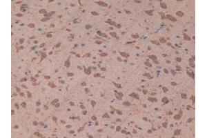 IHC-P analysis of Mouse Brain Tissue, with DAB staining. (TOLLIP 抗体  (AA 19-254))