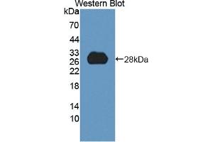 Detection of Recombinant HDLBP, Human using Polyclonal Antibody to High Density Lipoprotein Binding Protein (HDLBP) (HDLBP 抗体  (AA 158-371))