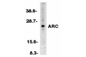 Western Blotting (WB) image for anti-ARC (N-Term) antibody (ABIN1031239) (ARC (N-Term) 抗体)