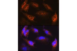Immunofluorescence analysis of U-251MG cells using  Rabbit pAb (ABIN6131182, ABIN6136830, ABIN6136831 and ABIN6222940) at dilution of 1:100 (40x lens). (ALS2 抗体  (AA 1-280))