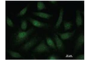 Immunostaining analysis in HeLa cells. (SATB1 抗体)