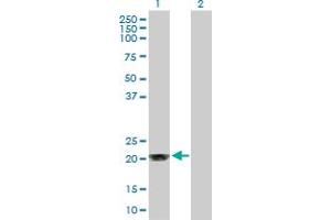 Western Blot analysis of MGMT expression in transfected 293T cell line by MGMT MaxPab polyclonal antibody. (MGMT 抗体  (AA 1-207))