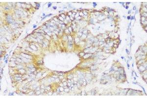 Immunohistochemistry (Paraffin-embedded Sections) (IHC (p)) image for anti-Enoyl Coenzyme A Hydratase 1, Peroxisomal (ECH1) antibody (ABIN7256490)