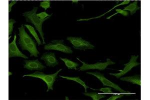 Immunofluorescence of monoclonal antibody to NDN on HeLa cell. (NDN 抗体  (AA 222-321))