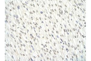 Immunohistochemistry (IHC) image for anti-Ewing Sarcoma Breakpoint Region 1 (EWSR1) (Middle Region) antibody (ABIN2779045)