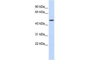 Human Brain; WB Suggested Anti-ADPGK Antibody Titration: 0. (ADPGK 抗体  (N-Term))