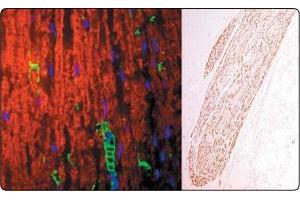 In the Left panel (a tissue section through an adult sciatic nerve), Po (green staining) can be seen in the myelin and Schwann cell processes surrounding the nodes of Ranvier. (MPZ 抗体)
