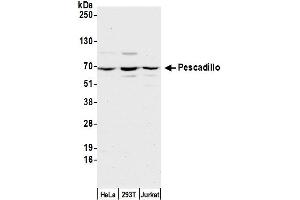 anti-Pescadillo Homolog 1 (PES1) (C-Term) antibody